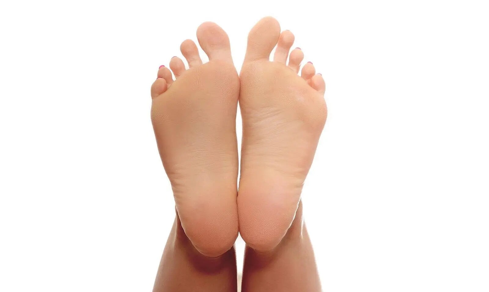 Types of Arch Support