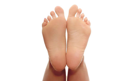 Types of Arch Support